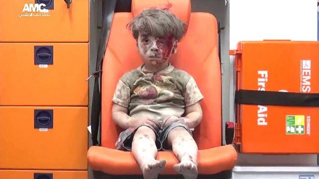 Un niño pequeño, cubierto de polvo y con sangre seca en la cara, sentado y descalzo en el asiento naranja de una ambulancia, junto a un maletín de primeros auxilios.